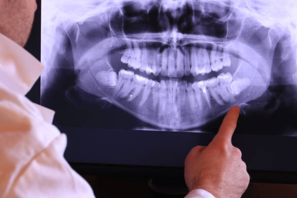 Best Emergency Dental Care for Broken or Chipped Teeth in Longtown, OK